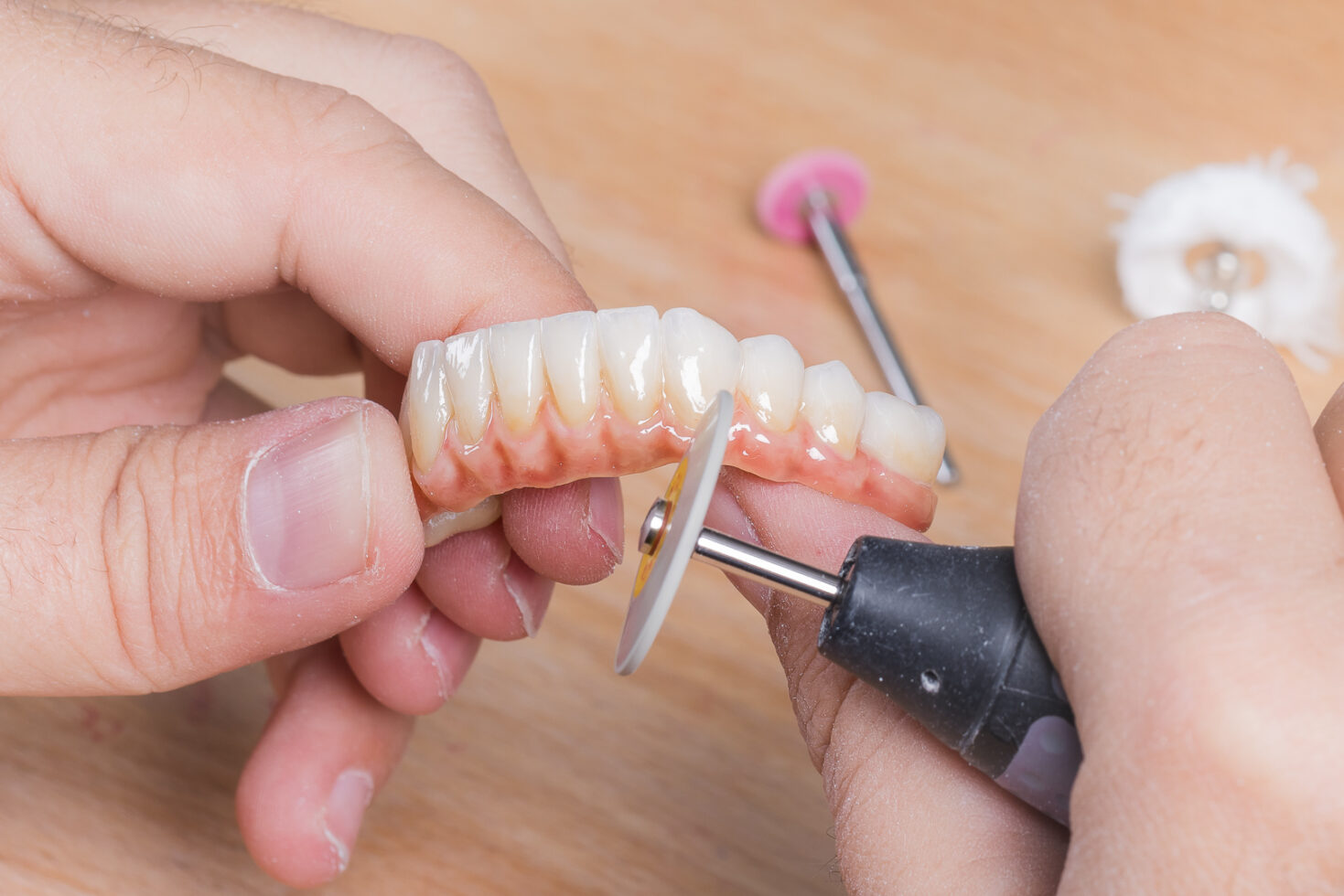 Complete or partial removable prosthesis
