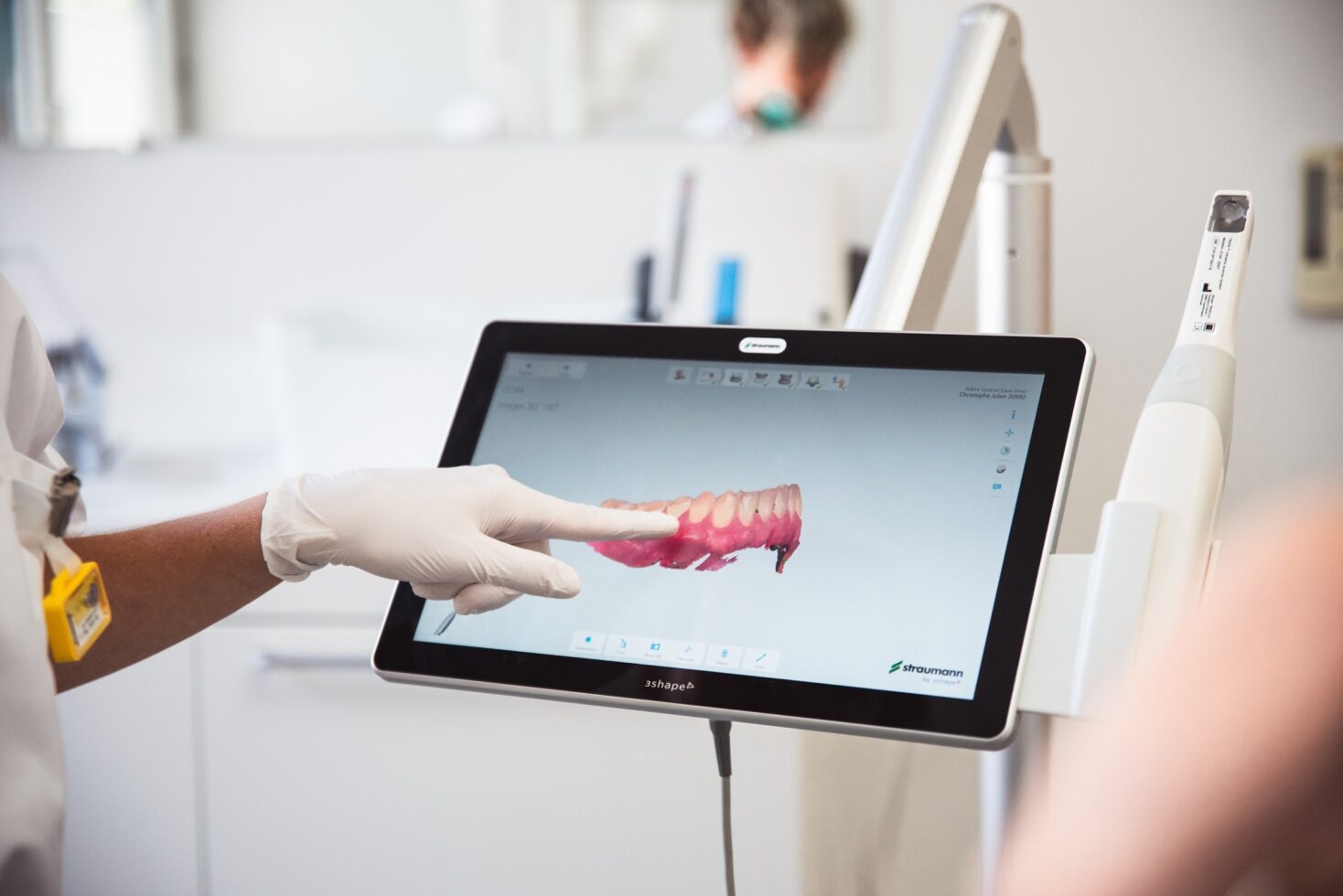 Scanner intraoral & empreintes numériques | Trios de 3SHAPE®