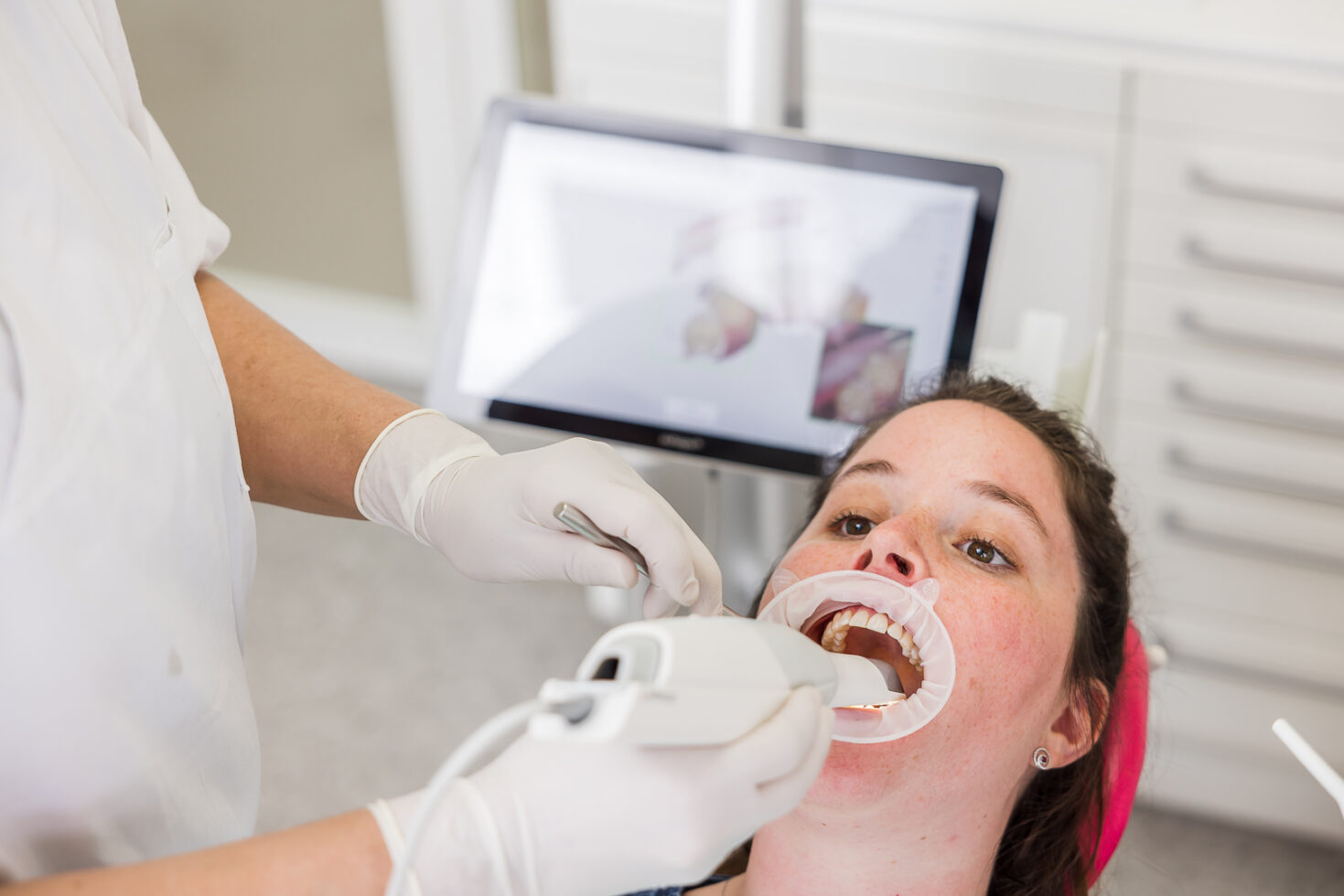 Caméra intraorale pour un diagnostic des caries sans radiation